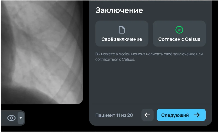 Выбор: своё заключение или согласие с Celsus