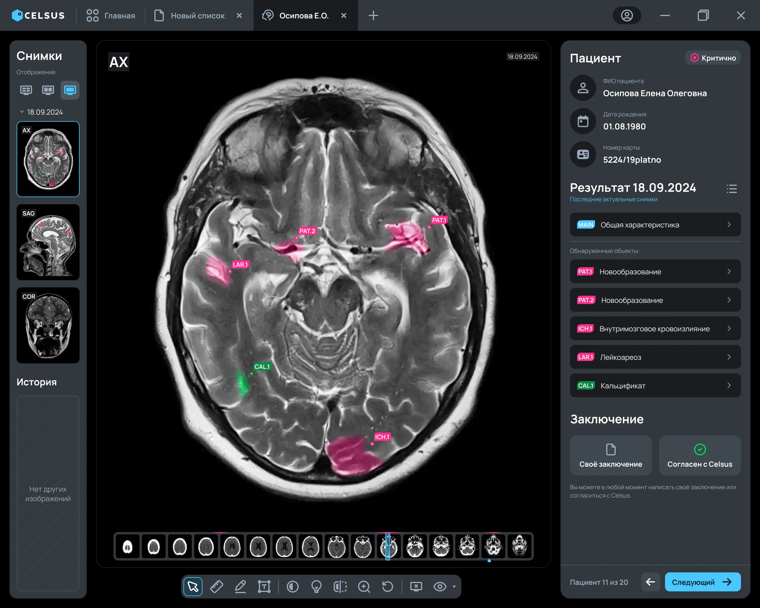 DICOM-Viewer Celsus