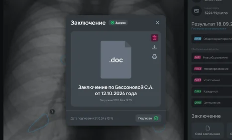 Загрузка готового заключения в формате документа