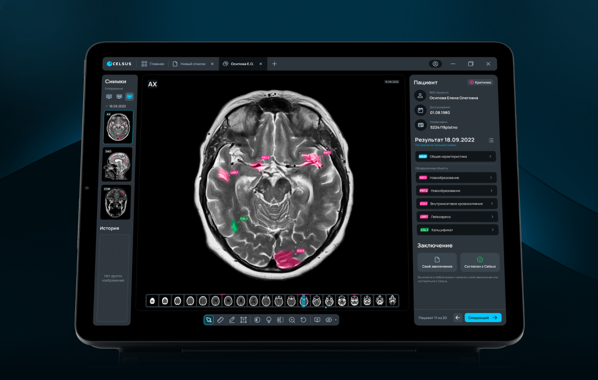 AI-сервис для рентгенологов